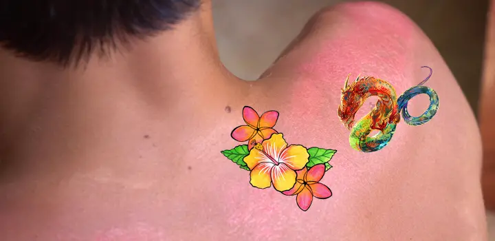 Sunburn On Tattoos