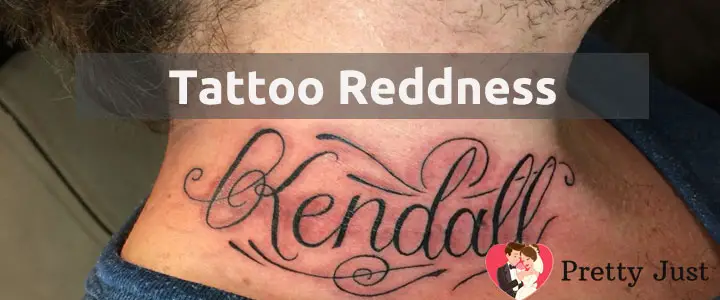 Tattoo Redness