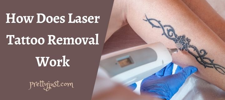 How Does Laser Tattoo Removal Work
