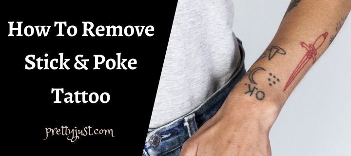 How To Remove Stick And Poke Tattoo