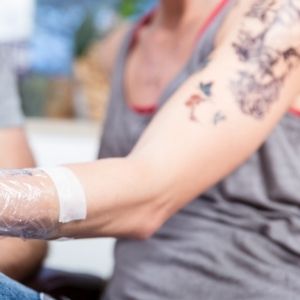 Laser Tattoo Removal Aftercare