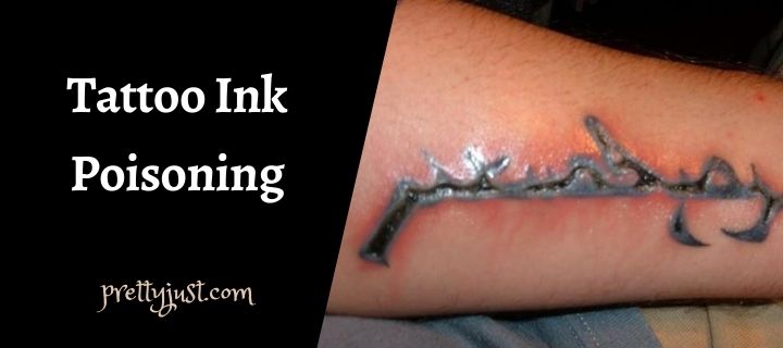 Tattoo Ink Poisoning Symptoms Causes  Treatment  AuthorityTattoo